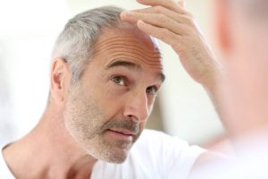 Significant progress in removing baldness thanks to stem cells
